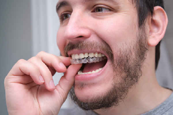Clear aligners