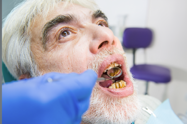 Dental implants